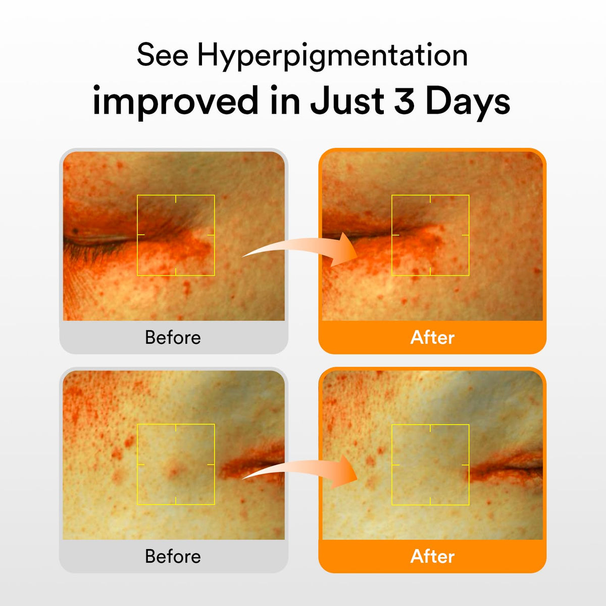 Abib Glutathiosome Dark Spot Serum Vita drop - 50mls | Korean Skincare, Dark Spot, Hyperpigmentation Treatment | Serum for Sensitive, Uneven Skin