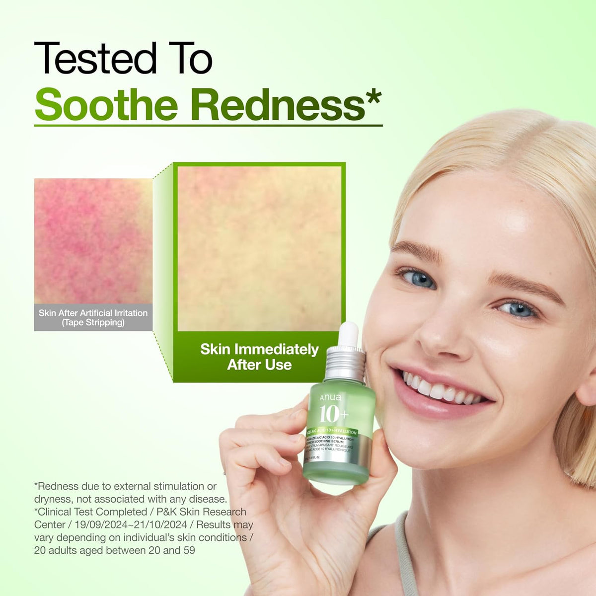 Anua Azelaic Acid 10 Hyaluron Redness Soothing Serum -  Facial Serum for Blemish-Prone & Oily-Prone Skin, Lightweight & Hydrating Blemish Care, Hyaluronic Acid - 30 ml
