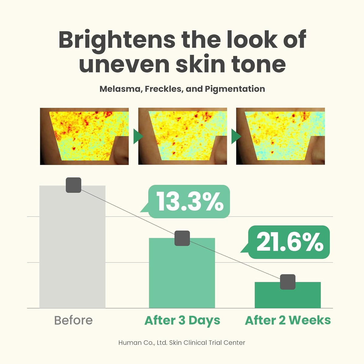 AXIS-Y Dark Spot Correcting Glow Serum - 5% Niacinamide Dark Spot Remover For Face