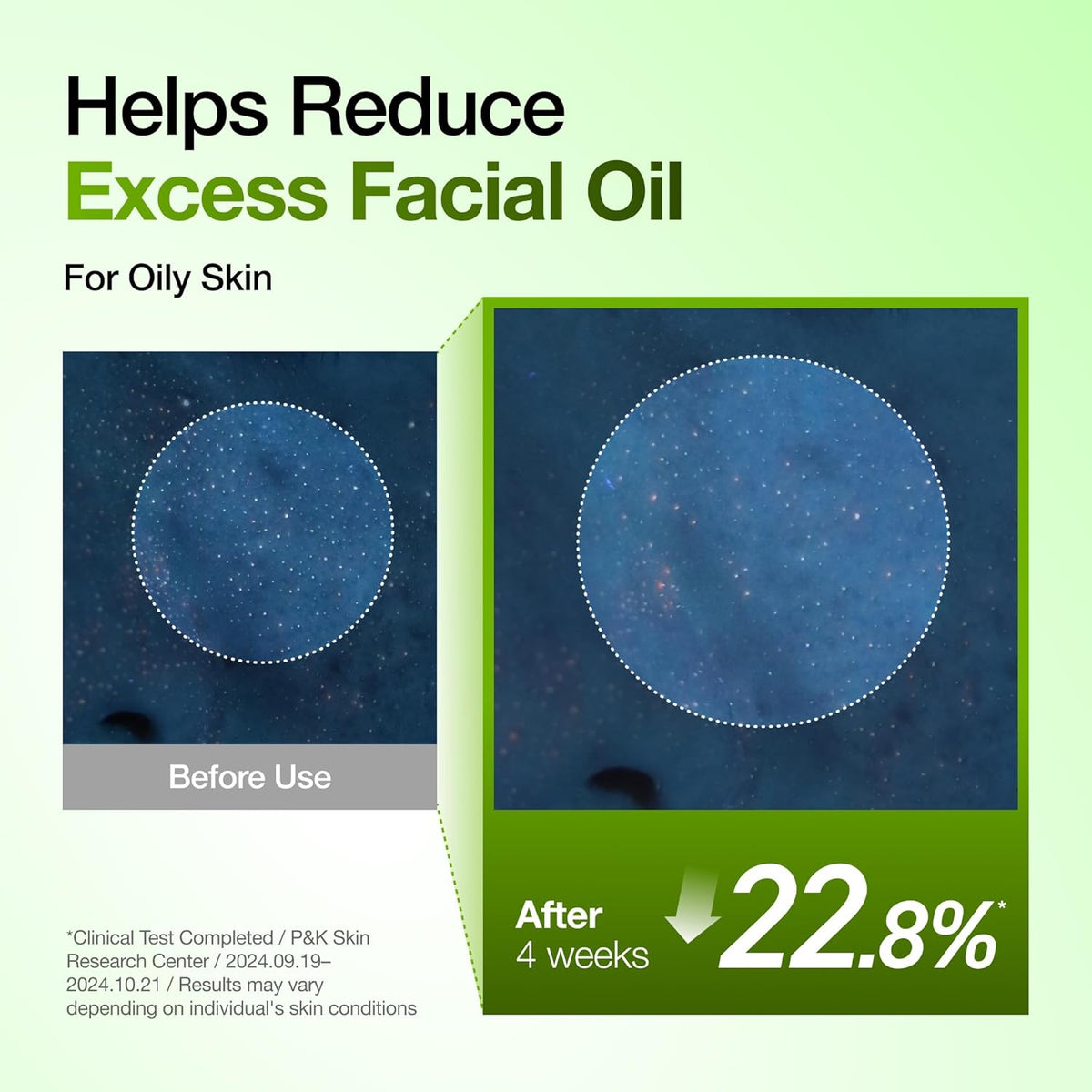 Anua Azelaic Acid 10 Hyaluron Redness Soothing Serum -  Facial Serum for Blemish-Prone & Oily-Prone Skin, Lightweight & Hydrating Blemish Care, Hyaluronic Acid - 30 ml